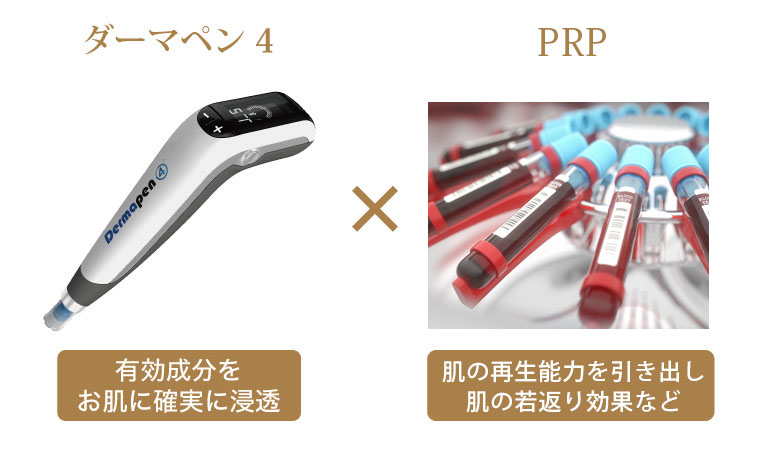 ヴァンパイアフェイシャル
