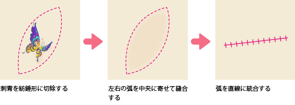 治療方法