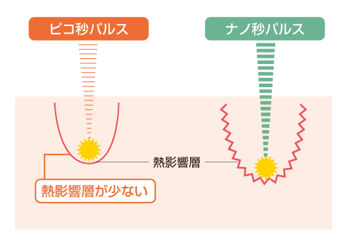 ピコレーザーの特徴