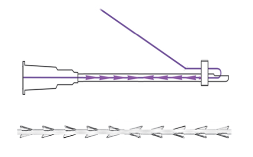 アフロディーテスレッドリフトの構造