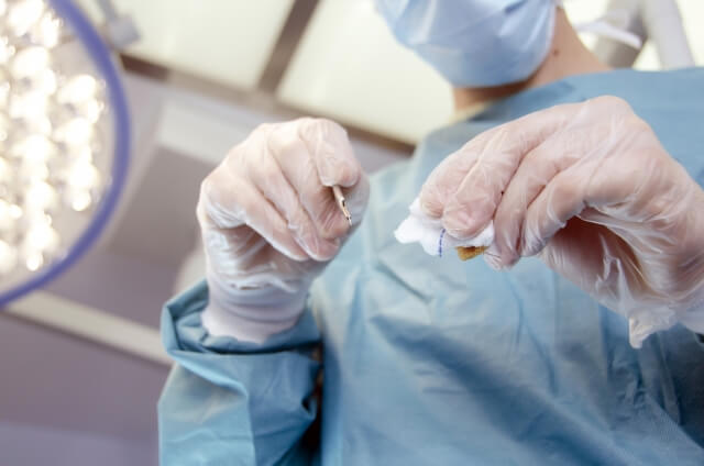 処女膜は形成外科手術で取り戻せる