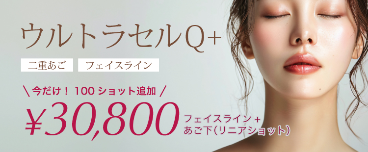 100ショット追加 30,800円