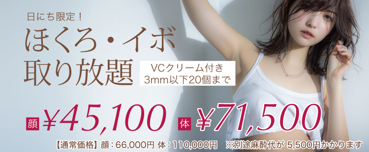 ほくろ取り放題