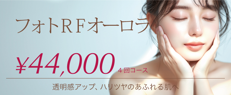 フォトRFオーロラ