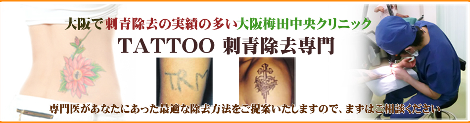 大阪で刺青除去の実績の多い大阪梅田中央クリニック
