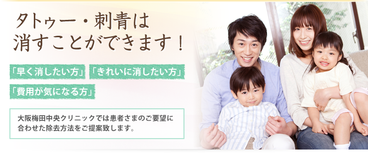 タトゥー・刺青は消すことができます！