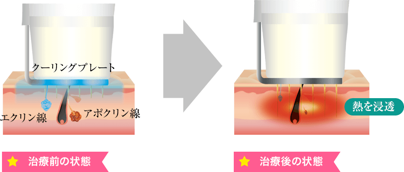 治療前後の状態