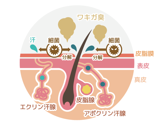 ワキガ臭の説明図